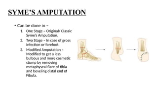 LOWER LIMB AMPUTATION SO much for [1].pptx