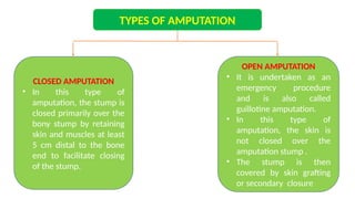 TYPES OF AMPUTATION
CLOSED AMPUTATION
• In this type of
amputation, the stump is
closed primarily over the
bony stump by retaining
skin and muscles at least
5 cm distal to the bone
end to facilitate closing
of the stump.
OPEN AMPUTATION
• It is undertaken as an
emergency procedure
and is also called
guillotine amputation.
• In this type of
amputation, the skin is
not closed over the
amputation stump .
• The stump is then
covered by skin grafting
or secondary closure
 