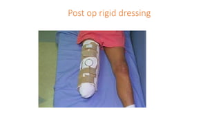 Post op rigid dressing
 