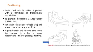 Positioning
• Major positions for either a patient
with a transtibial or transfemoral
amputation .
• To prevent Hip-flexion & Knee-flexion
contracture.
• Patient should be encouraged to spend
some time in the prone position.
• A pillow under the residual limb while
the patient is supine is never
recommended,nor is prolonged sitting.
 