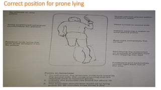 Correct position for prone lying
 