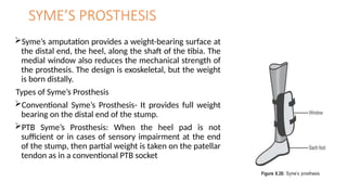 SYME’S PROSTHESIS
Syme’s amputation provides a weight-bearing surface at
the distal end, the heel, along the shaft of the tibia. The
medial window also reduces the mechanical strength of
the prosthesis. The design is exoskeletal, but the weight
is born distally.
Types of Syme’s Prosthesis
Conventional Syme’s Prosthesis- It provides full weight
bearing on the distal end of the stump.
PTB Syme’s Prosthesis: When the heel pad is not
sufficient or in cases of sensory impairment at the end
of the stump, then partial weight is taken on the patellar
tendon as in a conventional PTB socket
 
