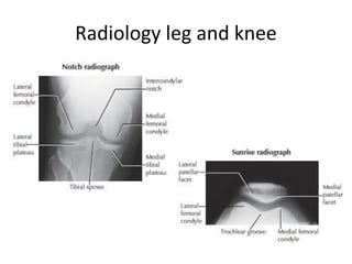 Radiology leg and knee