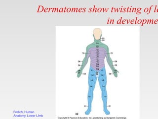Frolich, Human
Anatomy, Lower LImb
Dermatomes show twisting of le
in developme
 