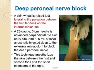 Deep peroneal nerve block
 A skin wheal is raised just
lateral to the pulsation between
the two tendons on the
intermalleolar line.
 A 25-gauge, 3-cm needle is
advanced perpendicular to skin
entry site, and 3–5 mL of local
anesthetic injected deep to the
extensor retinaculum to block
the deep peroneal nerve.
 This technique anesthetizes
the skin between the first and
second toes and the short
extensors of the toes.
1/4/2018 104
 