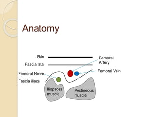 Anatomy
Pectineous
muscle
Iliopsoas
muscle
Fascia iliaca
Fascia lata
Skin
Femoral Vein
Femoral
Artery
Femoral Nerve
 
