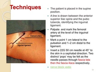 Techniques  The patient is placed in the supine
position.
 A line is drawn between the anterior
superior iliac spine and the pubic
tubercle, identifying the inguinal
ligament.
 Palpate and mark the femoral
artery at the level of the inguinal
ligament.
 Mark a point 1 cm lateral to the
pulsation and 1–2 cm distal to the
ligament.
 Insert a 22G 50 cm needle at 45° to
the skin in a cephalad direction. Two
distinct ‘pops’ may be felt as the
needle passes through fascia lata
then the fascia iliaca respectively.
 nerve block vedio
55
 