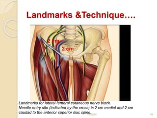 1/4/2018 66
Landmarks &Technique….
2 cm
2 cm
Landmarks for lateral femoral cutaneous nerve block.
Needle entry site (indicated by the cross) is 2 cm medial and 2 cm
caudad to the anterior superior iliac spine.
 