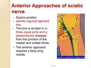 Anterior Approaches of sciatic
nerve
 Supine position
 Identify inguinal ligament
line.
 This line is divided in to
three equal parts and a
perpendicular dropped
from the junction of the
medial and middle thirds.
 The anterior approach
requires a fairly long
needle
1/4/2018 78
 