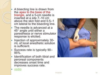  A bisecting line is drawn from
the apex to the base of the
triangle, and a 5-cm needle is
inserted at a site 7–10 cm
above the skin fold and 0.5–1
cm lateral to the bisecting line.
 The needle is advanced at a
45° angle until either a
paresthesia or nerve stimulator
response is elicited.
 Injection of approximately 30-
mL of local anesthetic solution
is sufficient.
 Success rate is typically 90–
95%.
 Identification of both tibial and
peroneal components
decreases onset time and
improves success rate.
 vedio
1/4/2018 91
 