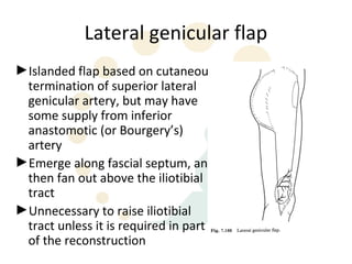 Lateral genicular flap
►Islanded flap based on cutaneous
 termination of superior lateral
 genicular artery, but may have
 some supply from inferior
 anastomotic (or Bourgery’s)
 artery
►Emerge along fascial septum, and
 then fan out above the iliotibial
 tract
►Unnecessary to raise iliotibial
 tract unless it is required in part
 of the reconstruction
 