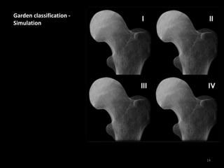 Garden classification -
Simulation
14
 