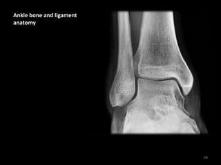 Ankle bone and ligament
anatomy
68
 