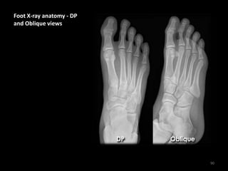 Foot X-ray anatomy - DP
and Oblique views
90
 