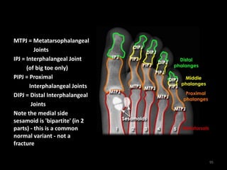 MTPJ = Metatarsophalangeal
Joints
IPJ = Interphalangeal Joint
(of big toe only)
PIPJ = Proximal
Interphalangeal Joints
DIPJ = Distal Interphalangeal
Joints
Note the medial side
sesamoid is 'bipartite' (in 2
parts) - this is a common
normal variant - not a
fracture
95
 