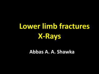 Lower limb fractures
X-Rays
Abbas A. A. Shawka
 