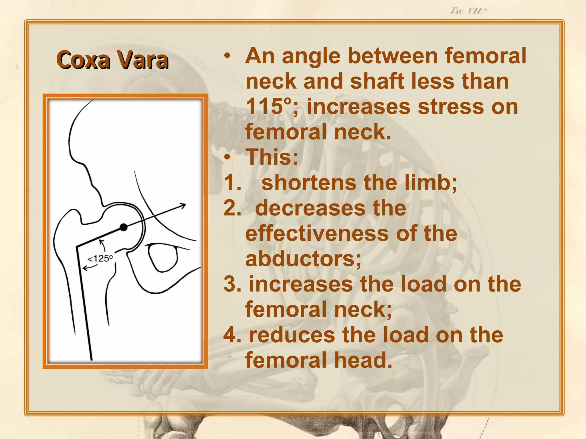 Coxa Vara

• An angle between femoral
neck and shaft less than
115°; increases stress on
femoral neck.
• This:
1. shortens the limb;
2. decreases the
effectiveness of the
abductors;
3. increases the load on the
femoral neck;
4. reduces the load on the
femoral head.

 