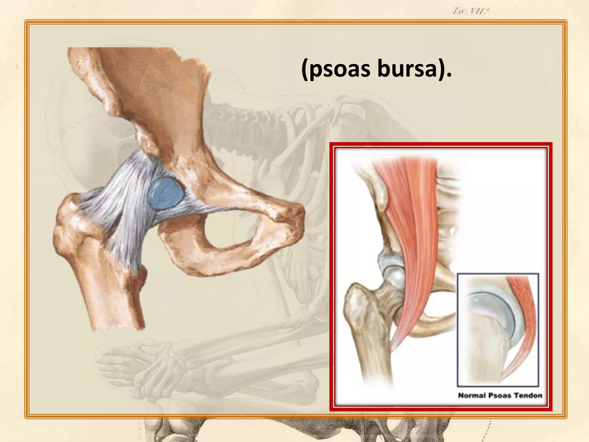 (psoas bursa).

 