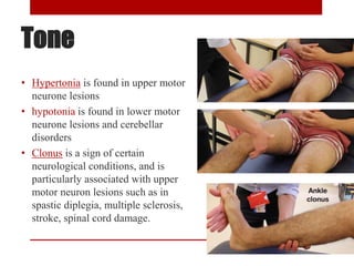 Tone
• Hypertonia is found in upper motor
neurone lesions
• hypotonia is found in lower motor
neurone lesions and cerebellar
disorders
• Clonus is a sign of certain
neurological conditions, and is
particularly associated with upper
motor neuron lesions such as in
spastic diplegia, multiple sclerosis,
stroke, spinal cord damage.
 
