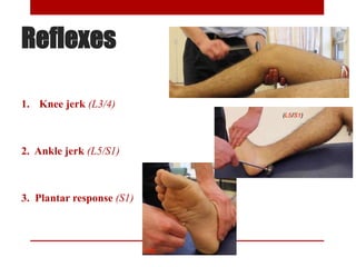 Reflexes
1. Knee jerk (L3/4)
2. Ankle jerk (L5/S1)
3. Plantar response (S1)
 