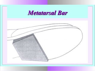 Metatarsal BarMetatarsal Bar
 