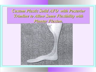 Custom Plastic Solid AFO with PosteriorCustom Plastic Solid AFO with Posterior
Trimline to Allow Some Flexibility withTrimline to Allow Some Flexibility with
Plantar FlexionPlantar Flexion..
 