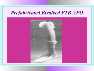 Prefabricated Bivalved PTB AFO
 