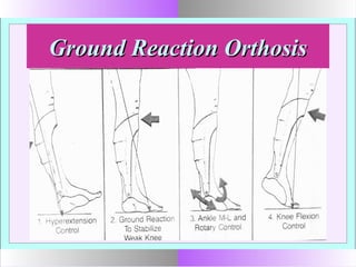 Ground Reaction OrthosisGround Reaction Orthosis
 