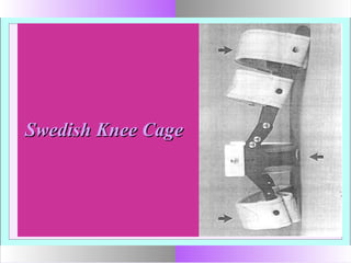 Swedish Knee CageSwedish Knee Cage
 