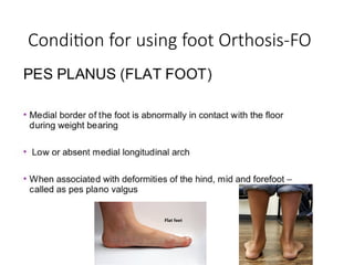 Condition for using foot Orthosis-FO
 