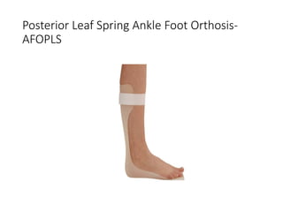 Posterior Leaf Spring Ankle Foot Orthosis-
AFOPLS
 