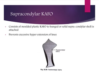 Supracondylar KAFO
• Consists of moulded plastic KAFO to hunged or solid supra-condylar shell is
attached
• Prevents excessive hyper extension of knee
 