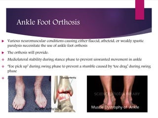 Ankle Foot Orthosis
 Various neuromuscular conditions causing either flaccid, athetoid, or weakly spastic
paralysis necessitate the use of ankle foot orthosis
 The orthosis will provide:
 Mediolateral stability during stance phase to prevent unwanted movement in ankle
 ‘Toe pick up’ during swing phase to prevent a stumble caused by ‘toe drag’ during swing
phase
 Near Normal Gait
Ankle Arthritis Muscle Dystrophy of Ankle
 
