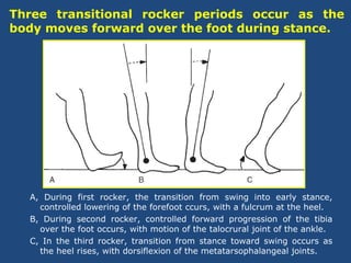 Tibia Rises Lower Limb Orthotics - Dr Rajendra Sharma | PPT