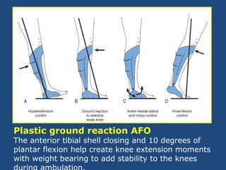 Plastic ground reaction AFO
The anterior tibial shell closing and 10 degrees of
plantar flexion help create knee extension moments
with weight bearing to add stability to the knees
 