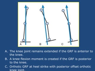 A. The knee joint remains extended if the GRF is anterior to
the knee.
B. A knee flexion moment is created if the GRF is posterior
to the knee.
C. Orthotic GRF at heel strike with posterior offset orthotic
 