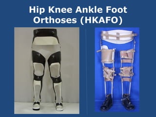 Hip Knee Ankle Foot
Orthoses (HKAFO)
 