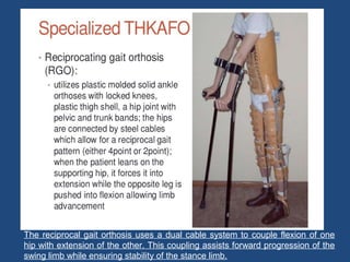 The reciprocal gait orthosis uses a dual cable system to couple flexion of one
hip with extension of the other. This coupling assists forward progression of the
swing limb while ensuring stability of the stance limb.
 