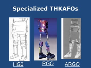 • The recent development of stance
control knee joints has eliminated
several drawbacks associated with
knee-ankle-foot or...