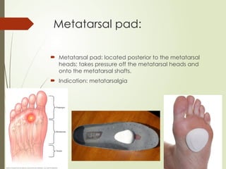 Metatarsal pad:
 Metatarsal pad: located posterior to the metatarsal
heads; takes pressure off the metatarsal heads and
onto the metatarsal shafts.
 Indication: metatarsalgia
 