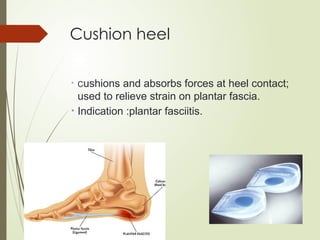 Cushion heel
• Cushions and absorbs forces at heel contact;
used to relieve strain on plantar fascia.
• Indication :plantar fasciitis.
 