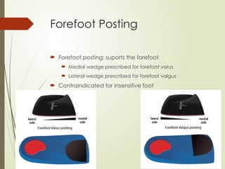 Forefoot Posting
 Forefoot posting: suports the forefoot
 Medial wedge prescribed for forefoot varus
 Lateral wedge prescribed for forefoot valgus
 Contraindicated for insensitive foot
 