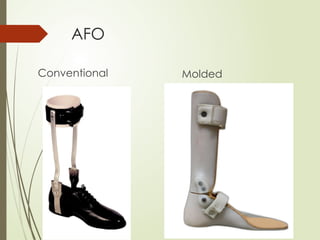 AFO
Conventional Molded
 