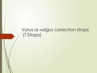 Varus or valgus correction straps
(T Straps)
 