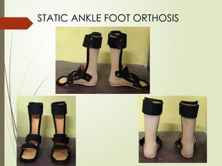STATIC ANKLE FOOT ORTHOSIS
 