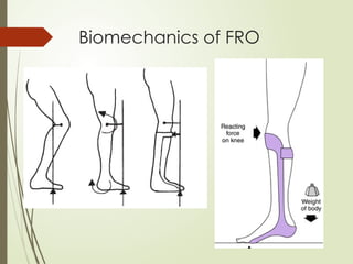 Biomechanics of FRO
 