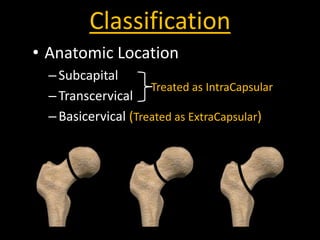 Lower limb fractures part 1 (for UGs) | PPTX
