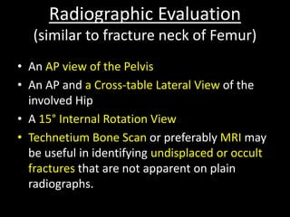 Traction Internal Rotation View Lower limb fractures part 1 (for UGs) | PPTX