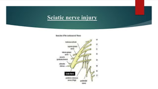 Sciatic nerve injury
 
