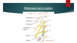 Obturator nerve injury
 